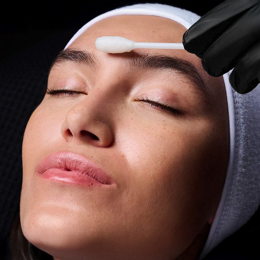 Consulta dermatológica en Racderma