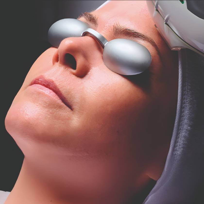 Tratamiento láser con Racderma