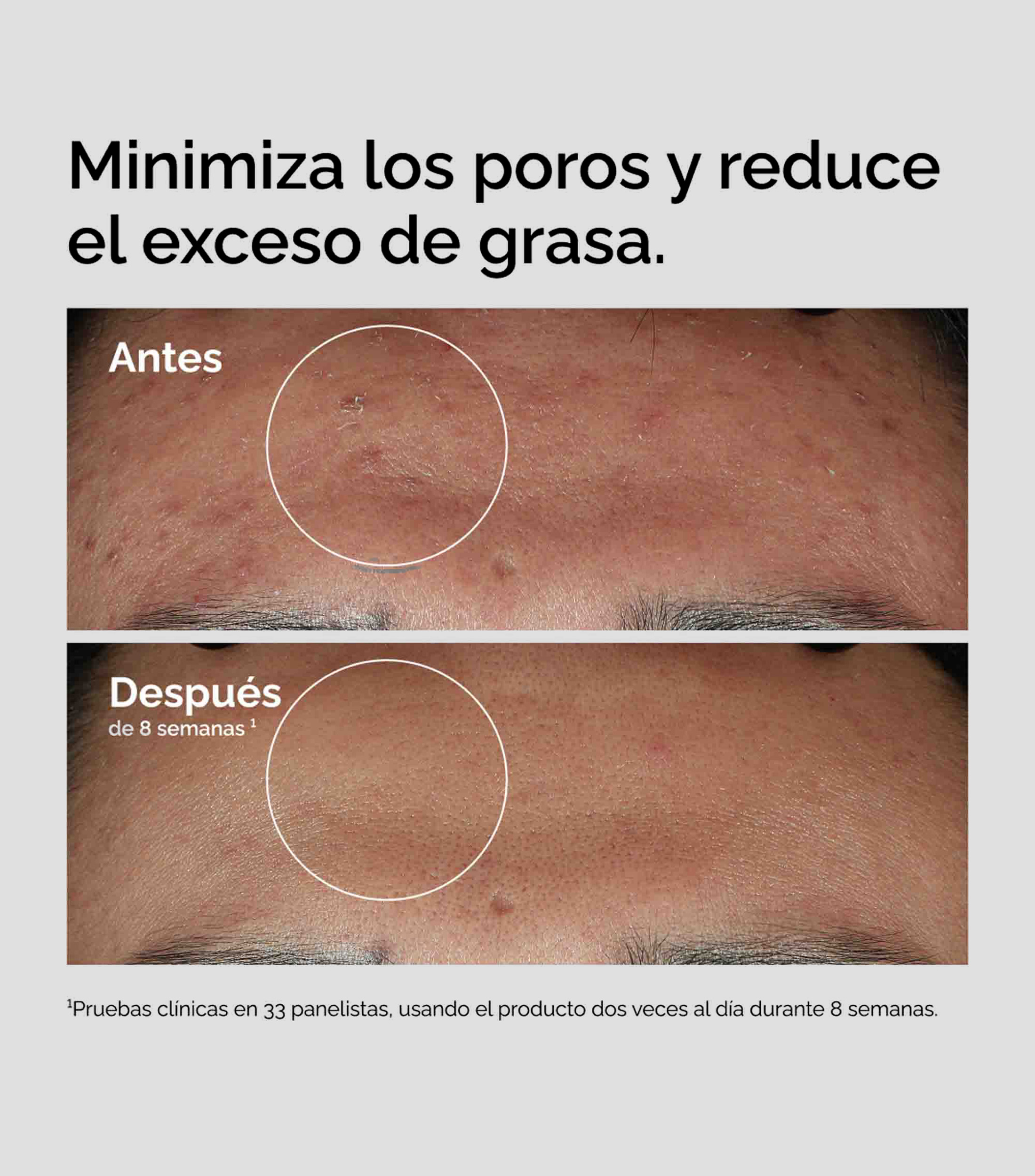 Sérum Control de Imperfecciones Niacinamide 10% + Zinc 1%, 30 ml