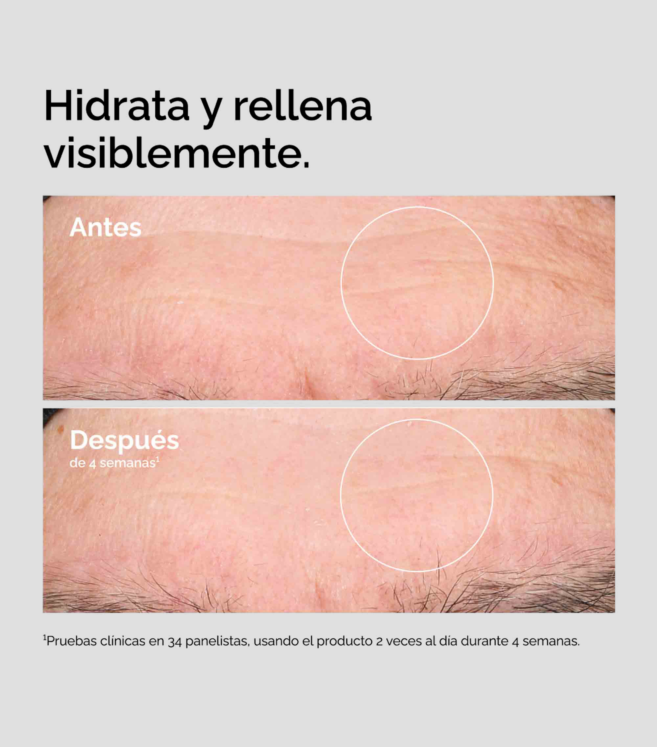 Sérum Hidratante Ácido Hialurónico 2% + B5, 60 ml