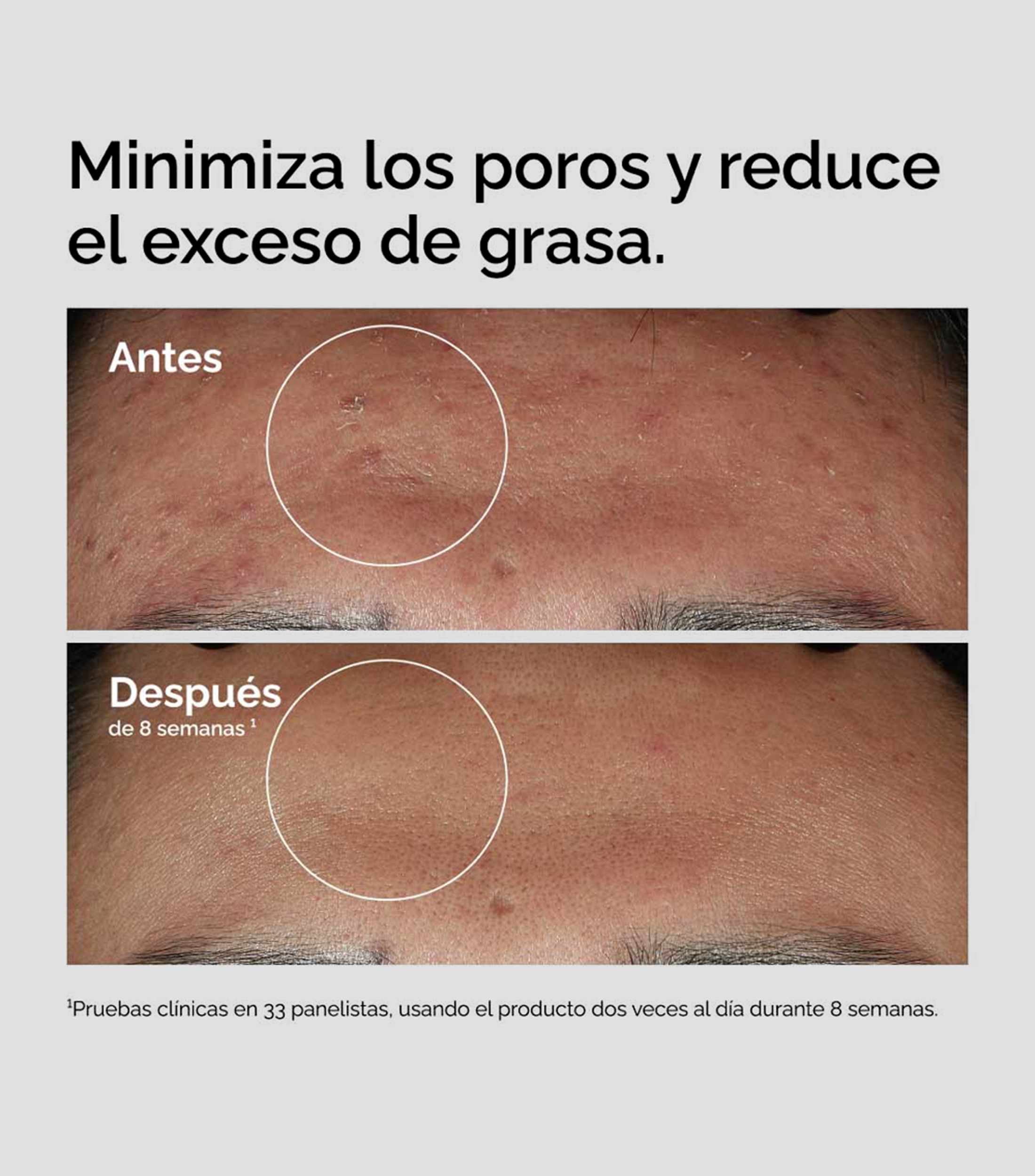 Sérum Regulador de Grasa Niacinamide 10% + Zinc 1%, 60 ml