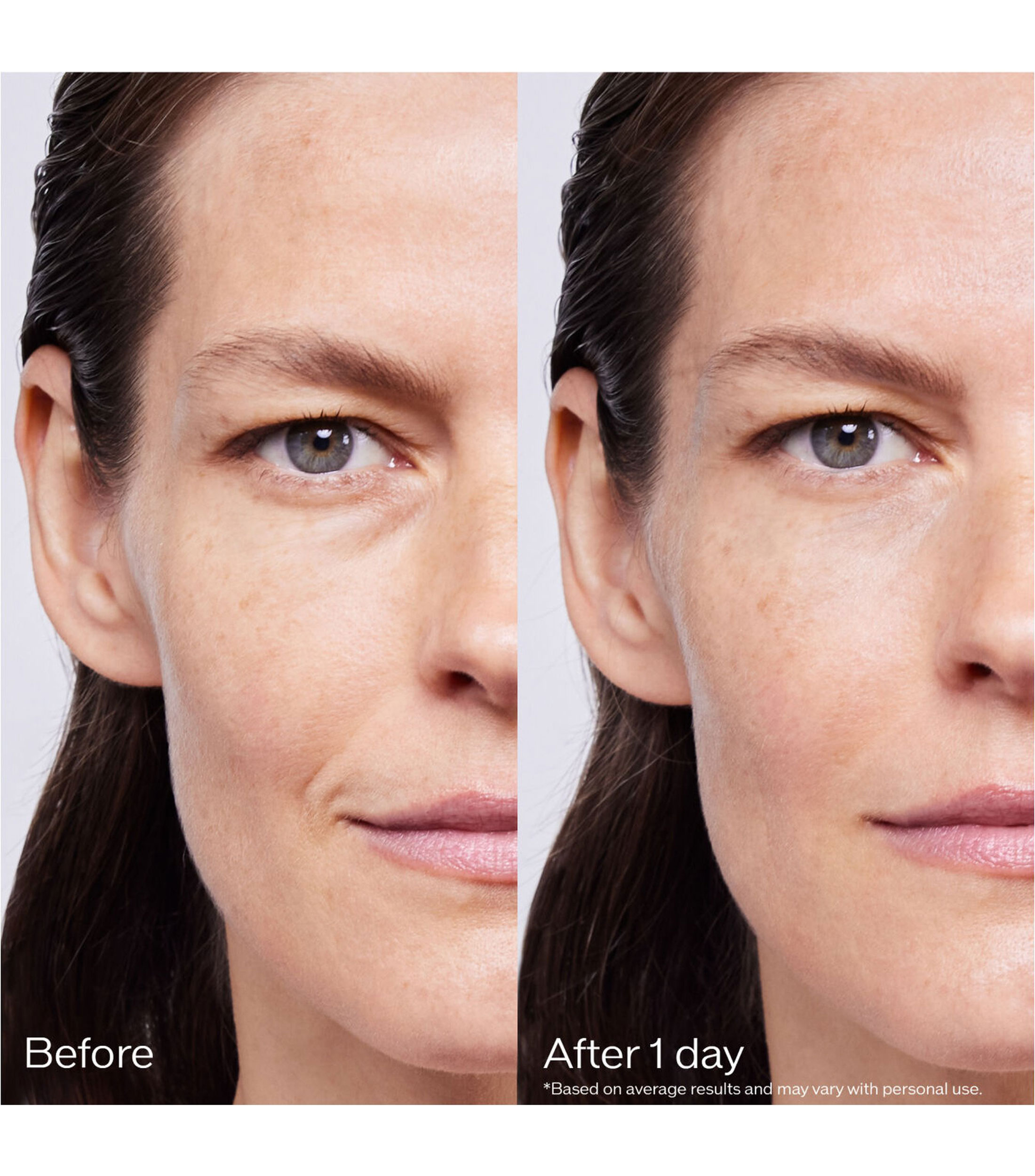 Set de sueros anti edad Bio Performance Skin Filler Mujer