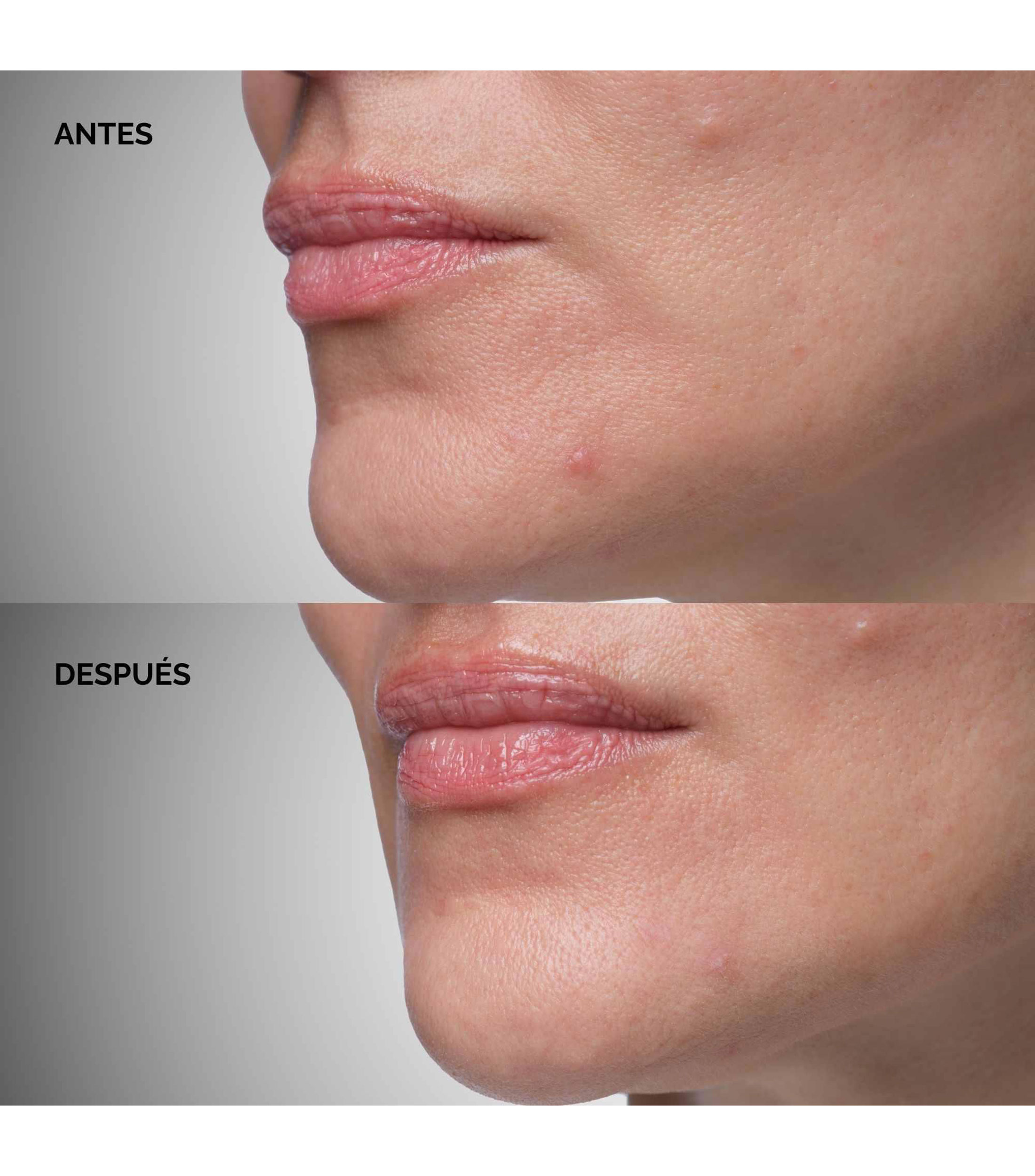 Tratamiento Anti-imperfecciones Crema en Polvo Sulfur 10 Power-to-Cream Concéntrate, 5 gr