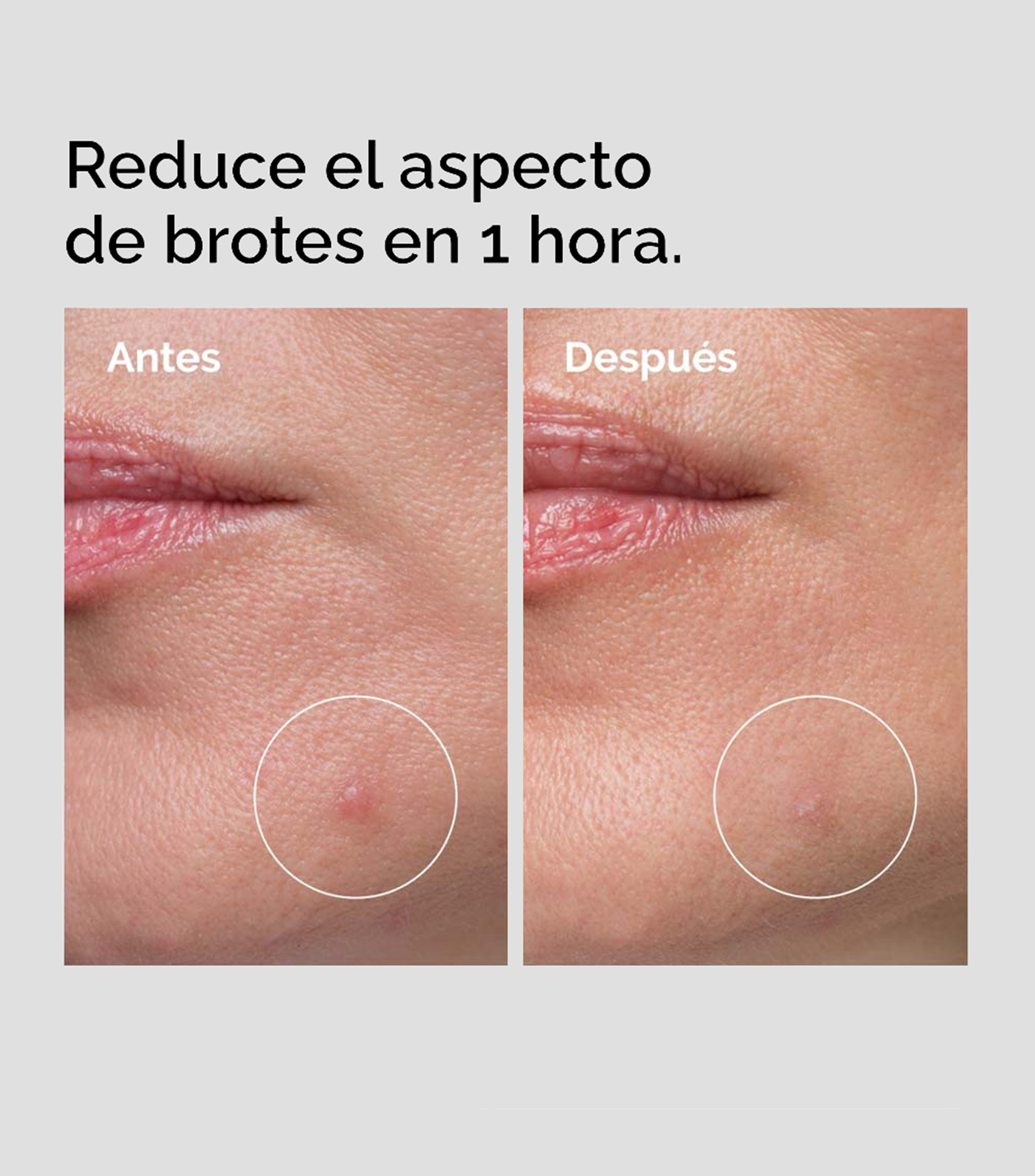 Tratamiento Anti-imperfecciones Crema en Polvo Sulfur 10 Power-to-Cream Concentrate, 5 gr